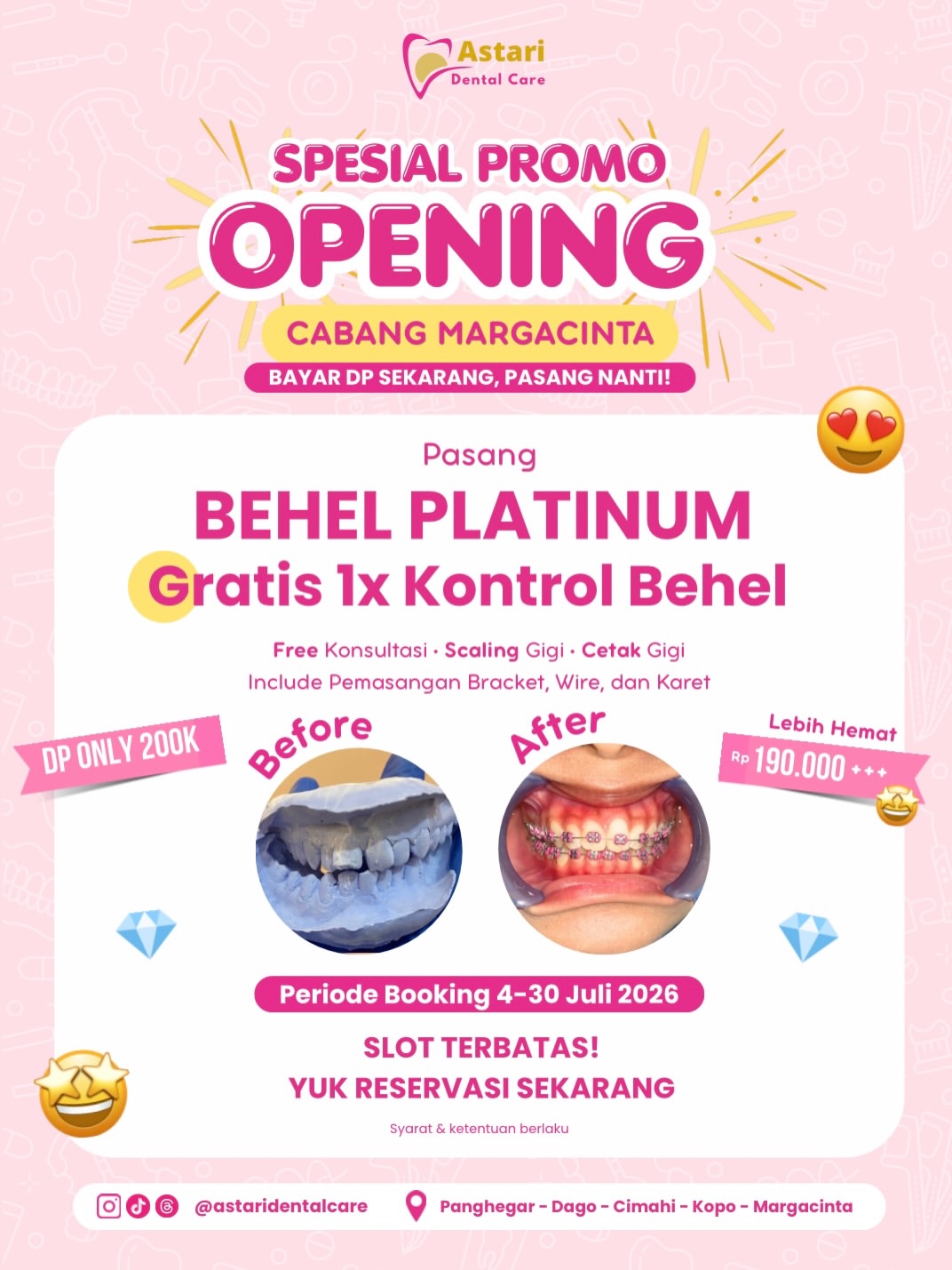 Promo Opening Margacinta